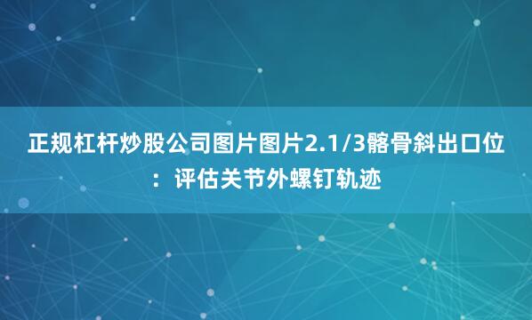 正规杠杆炒股公司图片图片2.1/3髂骨斜出口位：评估关节外螺钉轨迹